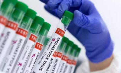 Secretaria de Saúde confirma um novo caso de monkeypox